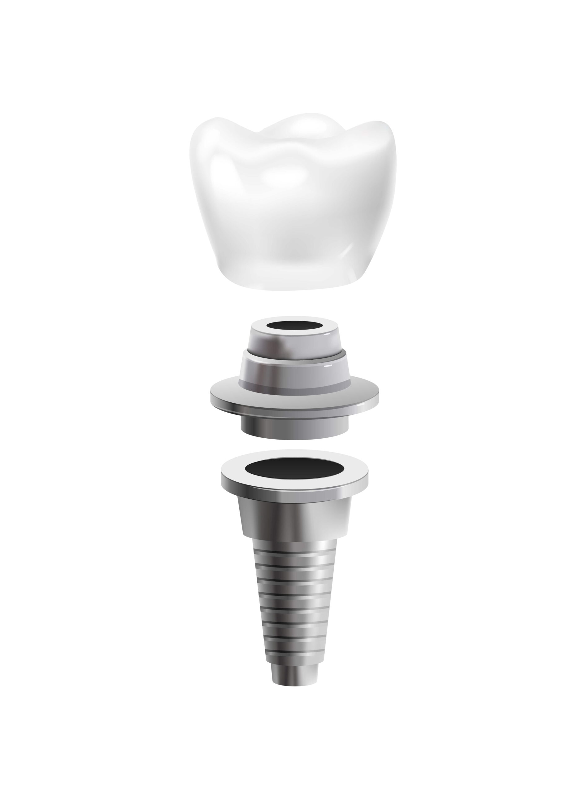 Implantes Dentales 2008.i305.029.p.m005.c25.realistic tooth anatomy set 02