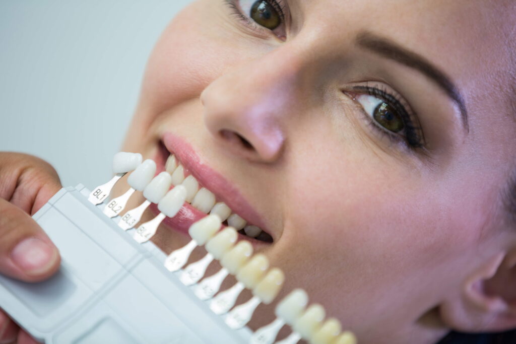 Implantes Dentales dentist examining female patient with teeth shades