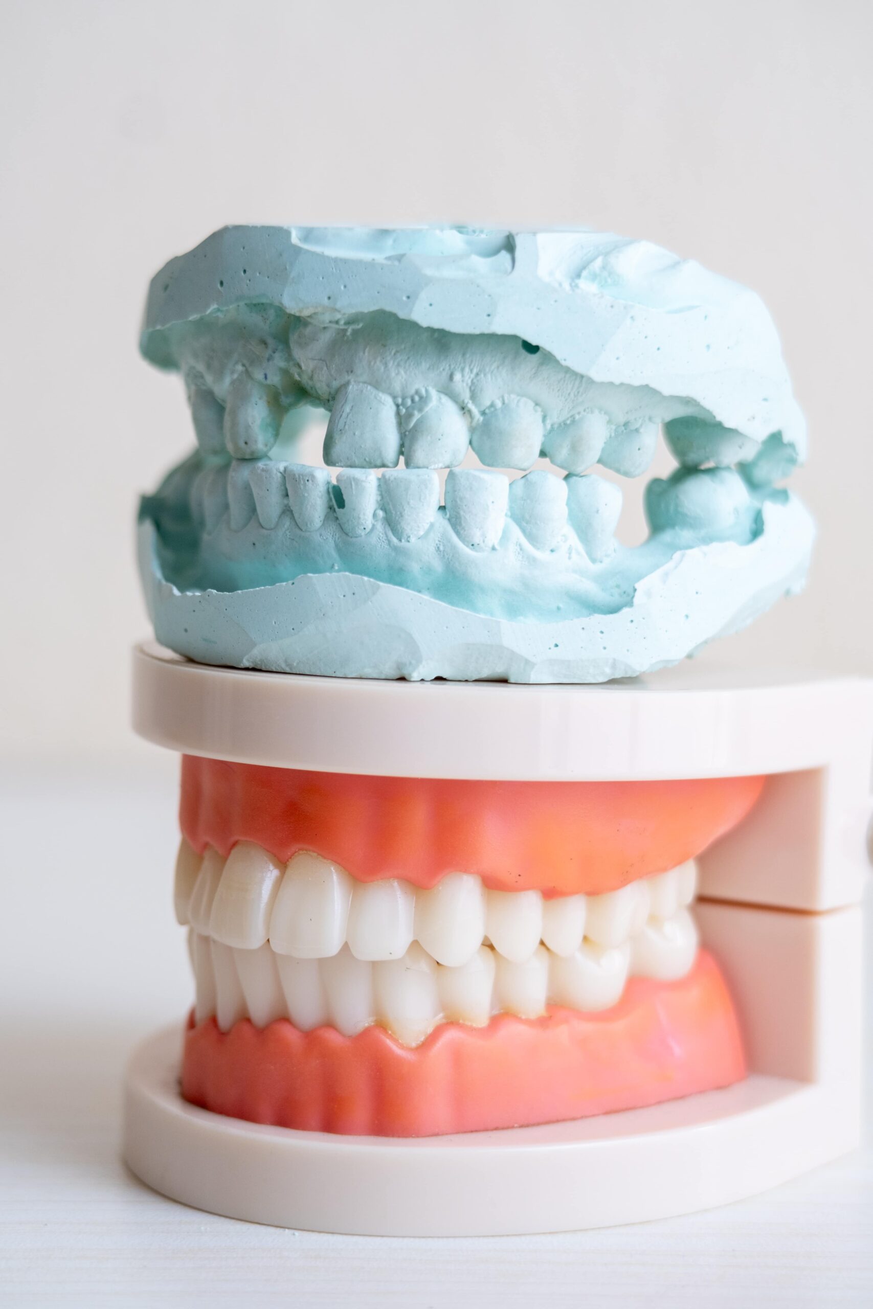 dental model plaster cast human teeth