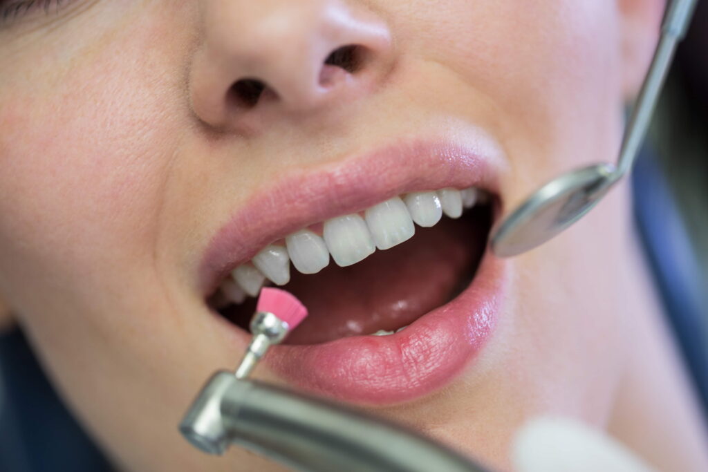 dentist examining female patient with tools (1)